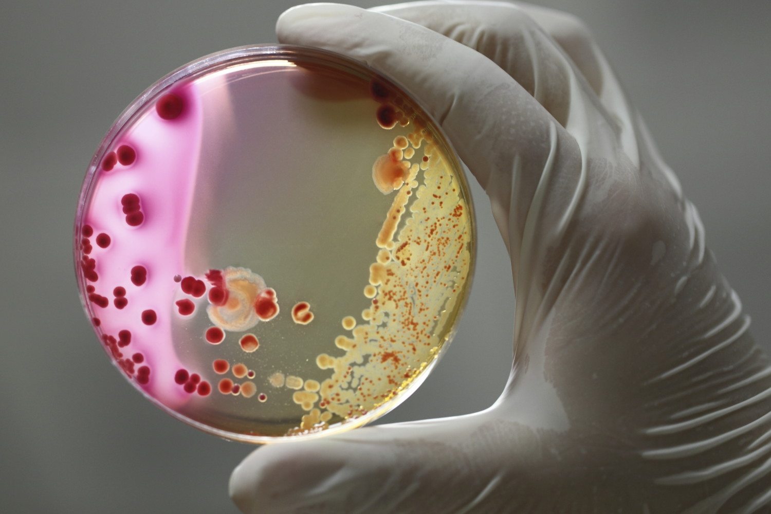 Бактериология, современные бактериологические методы исследований, 144 часа (повышение квалификации)